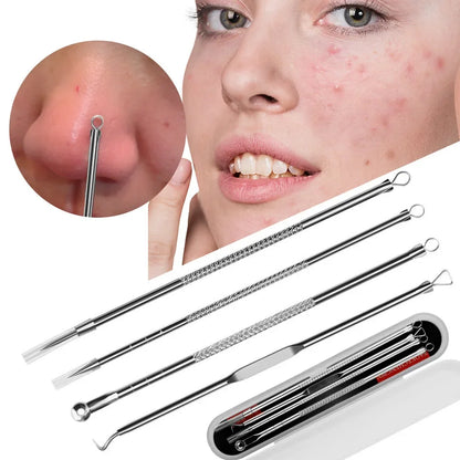 Stainless Steel Blackhead Remover Set